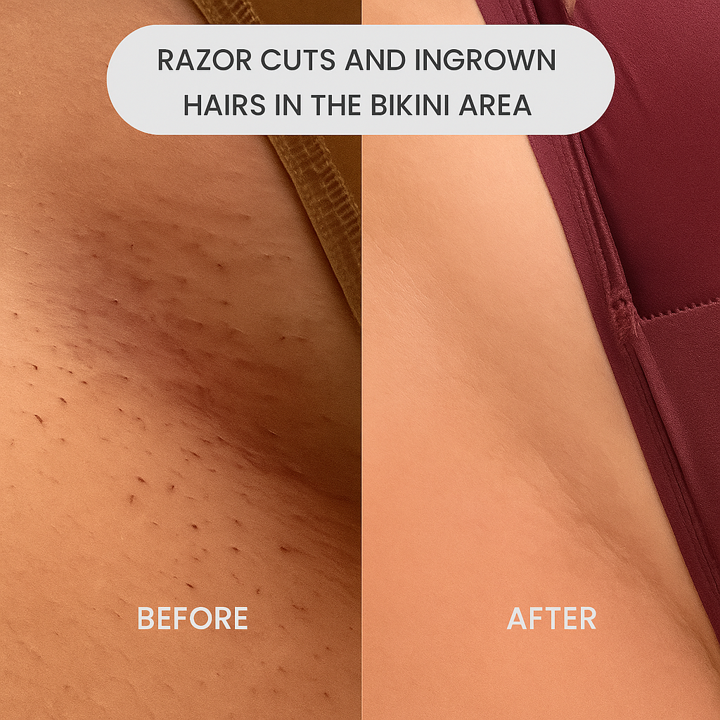 Flaurielle SilkTrim – Precision Bikini & Body Trimmer